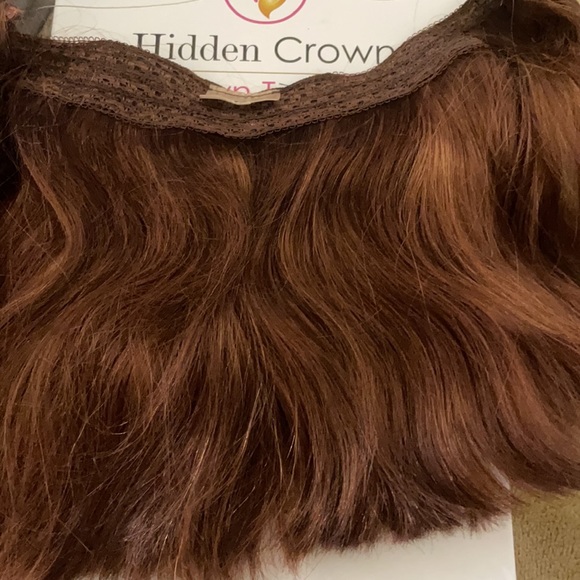 Hidden crown extensions - Picture 2 of 2